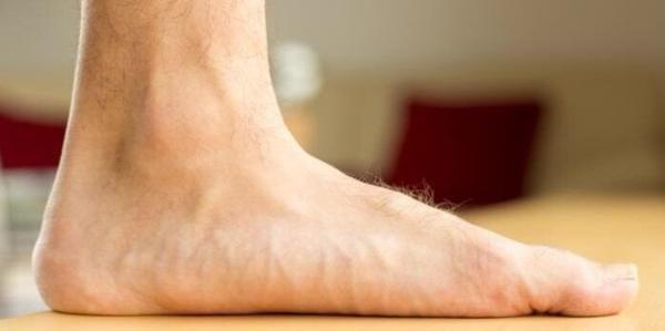یک متخصص برجسته ارتوپدی و جراح کف پا: جراحی، درمان قطعی و نهایی کف پای صاف است